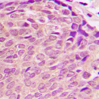  - Anti-PDK2 Antibody AP60498